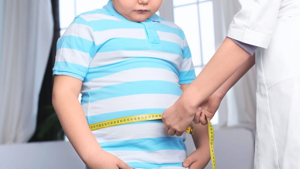 obesitas anak